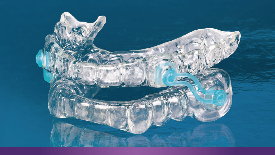 Sleep Apnea and Snoring Devices Infinity Dental Associates