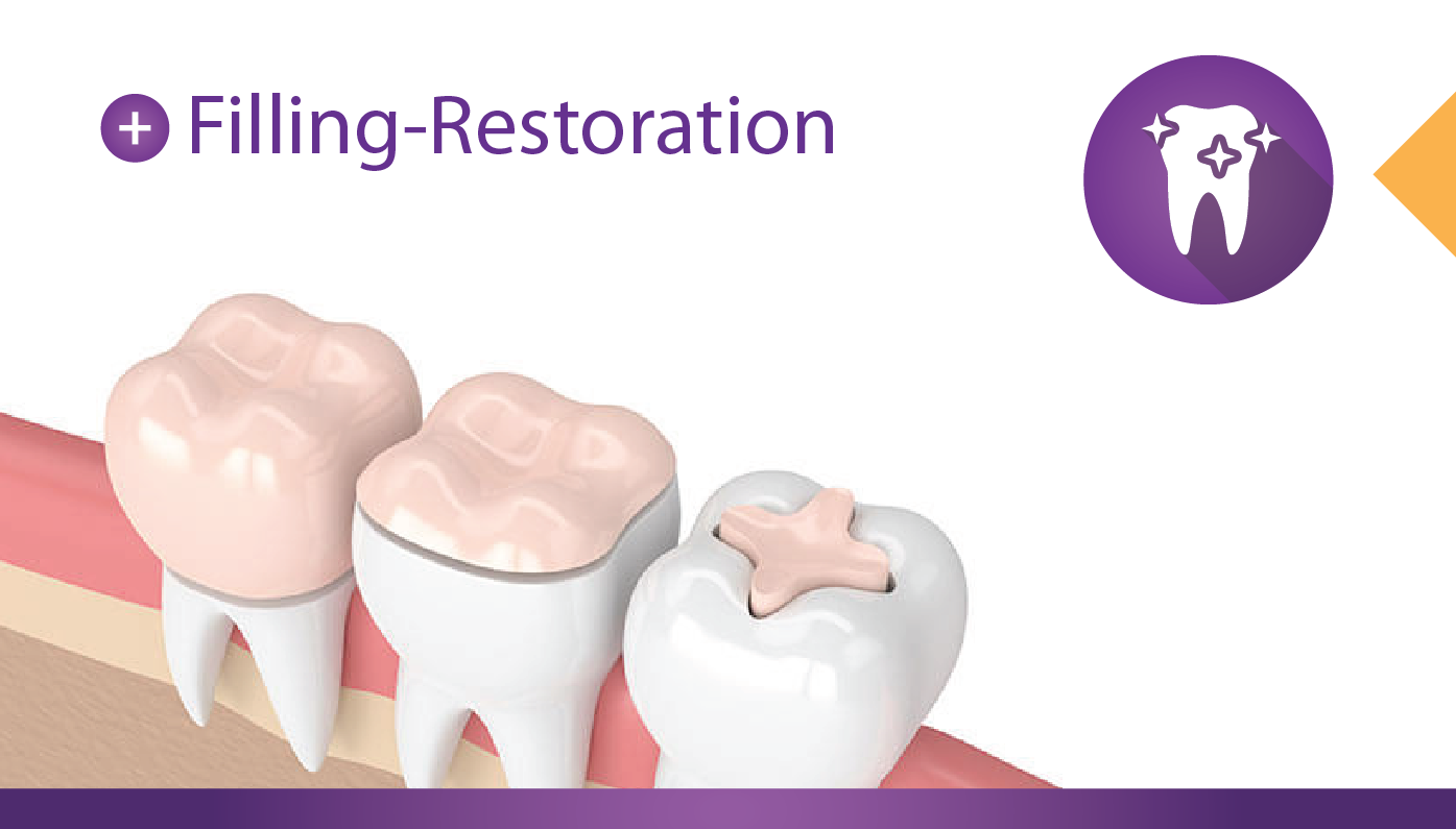 FillingRestoration cases Infinity Dental Associates